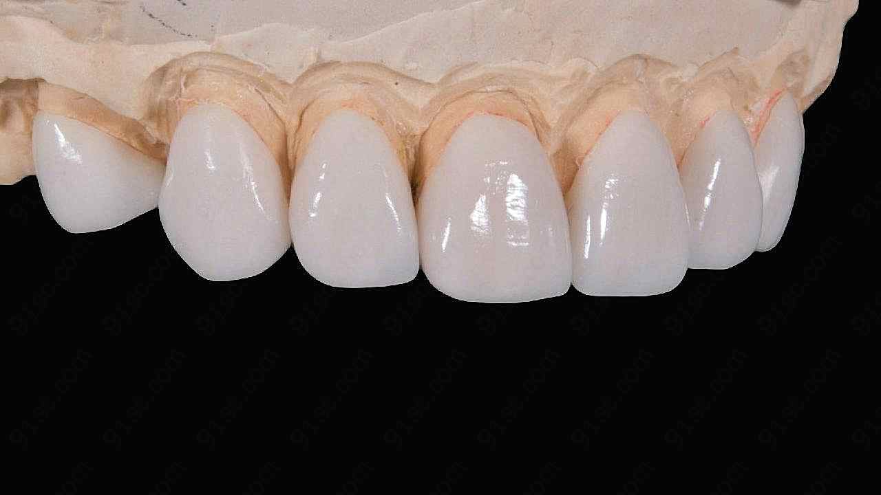 牙齿模型图片高清